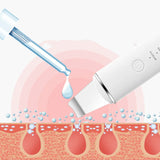 The Advanced Sonic Skin Exfoliator Cleansing Device Eliminates Pore Impurities